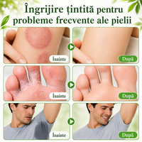 DermaPur™ – Săpun cu ulei de arbore de ceai pentru pielea cu probleme