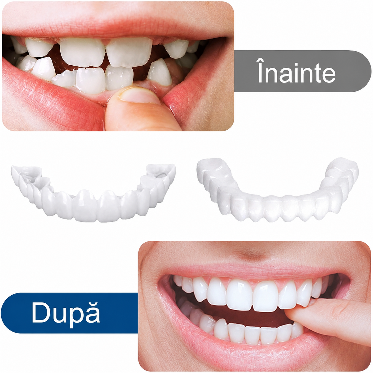 NovaSmile™ – Fațete Dentare Detașabile Tip Snap-On