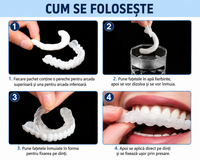NovaSmile™ – Fațete Dentare Detașabile Tip Snap-On
