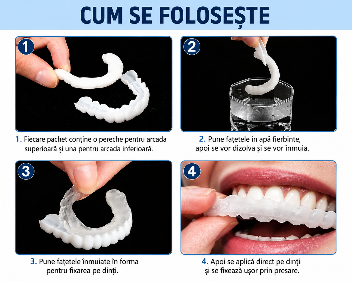 NovaSmile™ – Fațete Dentare Detașabile Tip Snap-On